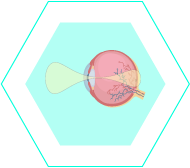 L’hypermétropie